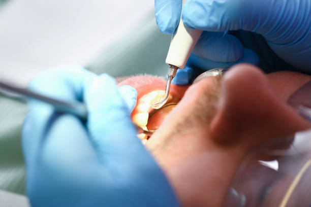 Best Emergency Dental Services for Seniors in Childersburg, AL