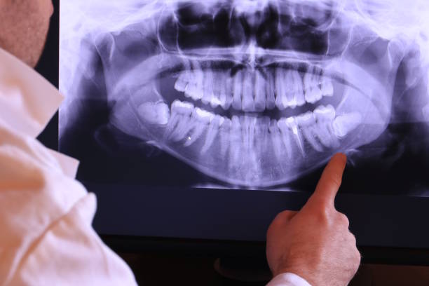 Best Urgent Dental Care for Toothache in Childersburg, AL