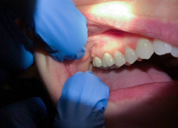 Best Weekend Emergency Dentist in Childersburg, AL